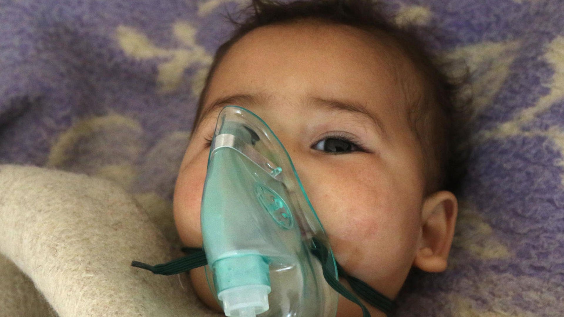 A small child injured in a suspected chemical gas attack in Idlib, Syria receives treatment  with an oxygen mask