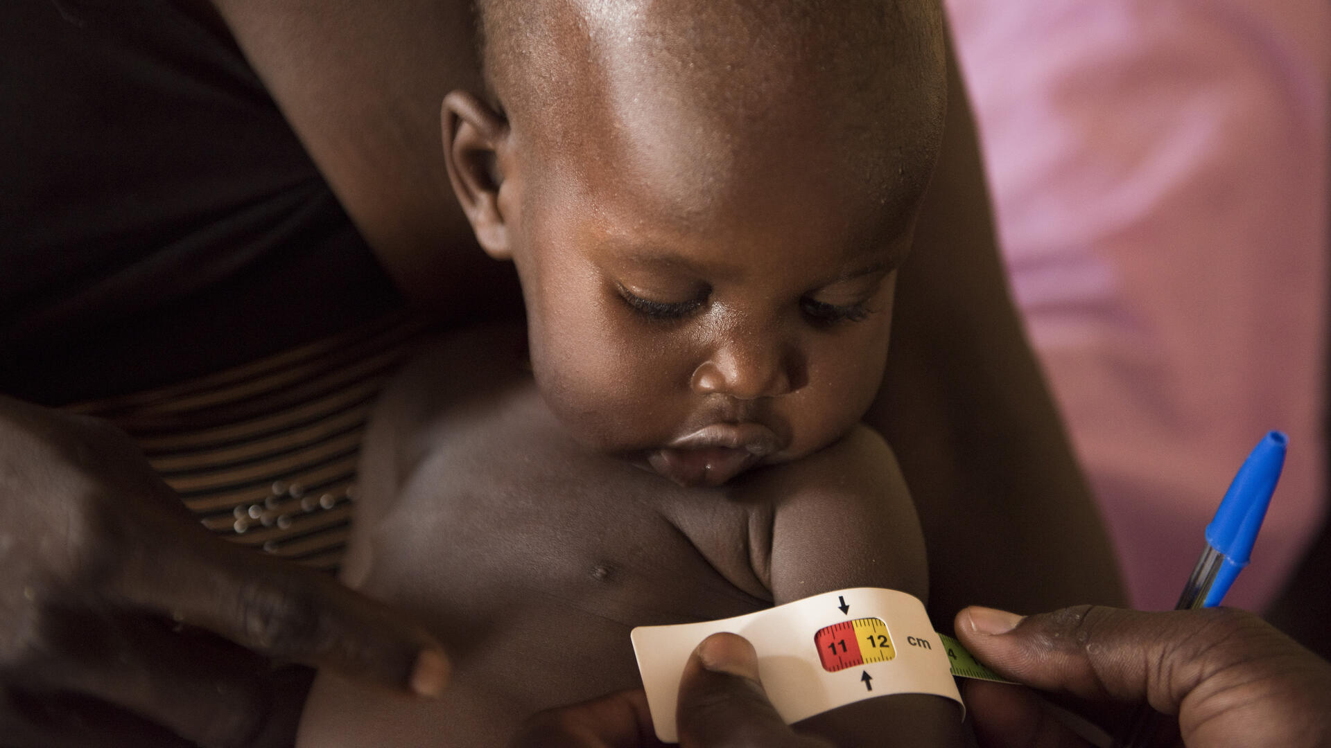 A MUAC tape around a South Sudanese baby's upper arm shows that he is at risk of acute malnutrition
