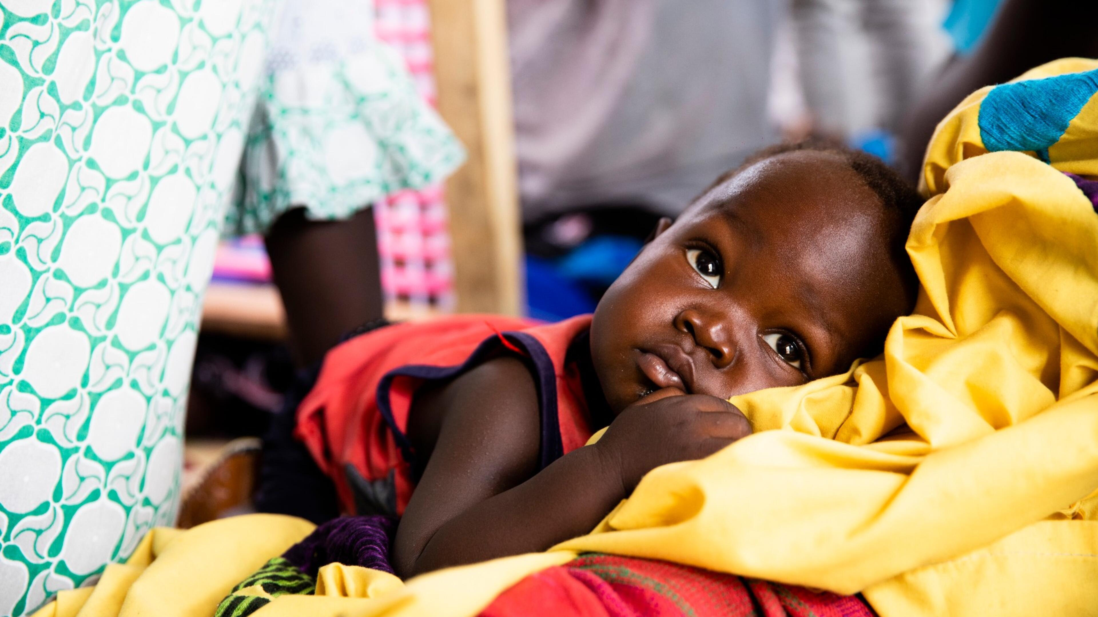 A groundbreaking approach to treating acute malnutrition - Vimarsana News